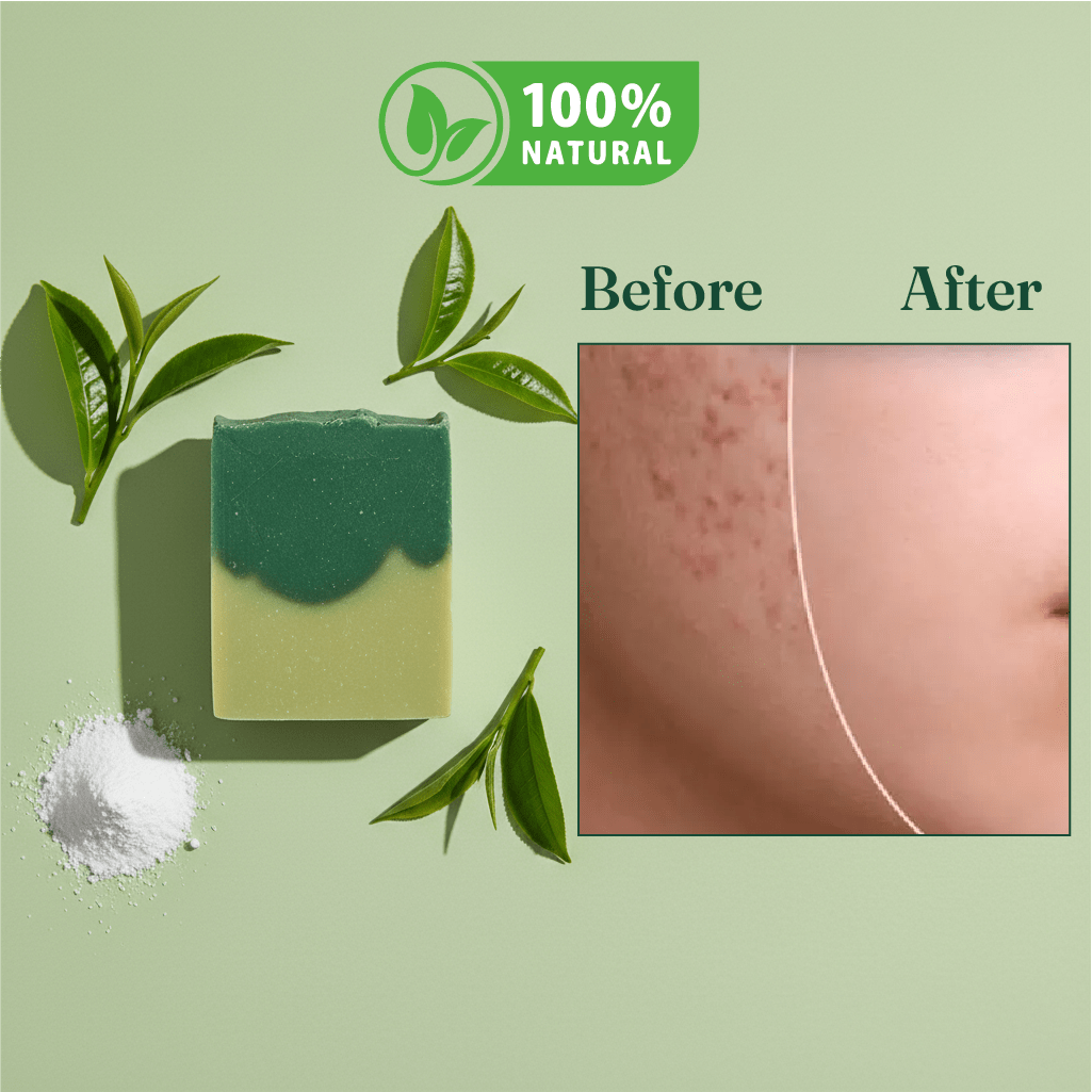 ecofresh detox soap – organic soap ecofresh detox soap – organic soap